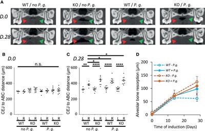 NLRP3 Is Involved in Neutrophil Mobilization in Experimental Periodontitis